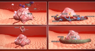 mCRC mechanism of disease at the cellular level